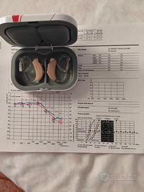 Apparecchi acustici belton