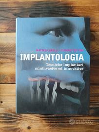 Libro implant. Matteo Capelli - Tiziano Testori