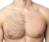 Depilazioni maschili