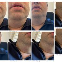 Ipad mini 7 Wi-Fi più Cellular