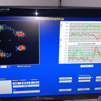 Pedana Baropodometrica e Stabilometrica
