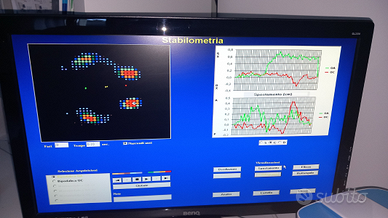 Pedana Baropodometrica e Stabilometrica