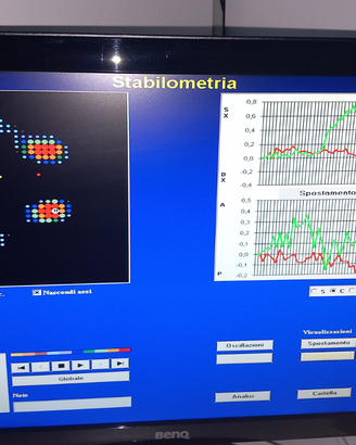 Pedana Baropodometrica e Stabilometrica