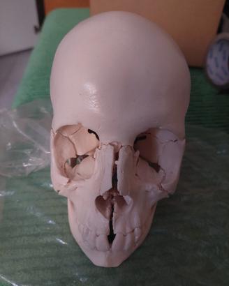 cranio scomponibile
