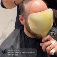 Protesi capelli donna e uomo