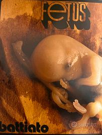 Battiato - Fetus  vinile 2009