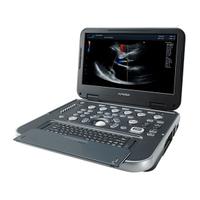 Ecografo portatile Alpinion E-Cube i7