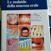 le malattie della mucosa orale 