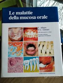 le malattie della mucosa orale 