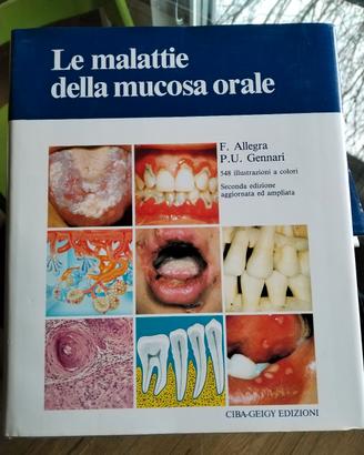 le malattie della mucosa orale 