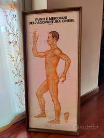 Quadro con stampa punti e meridiani di agopuntura 