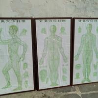 Tre vecchie tavole cinesi per agopuntura