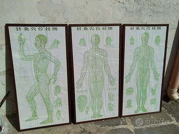 Tre vecchie tavole cinesi per agopuntura