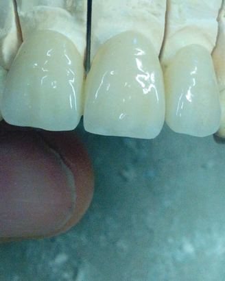 Odontotecnico