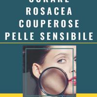 Curare Rosacea Couperose e Pelle Sensibile