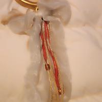 albero con fiocco thun