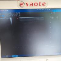 Ecografo Esaote My Lab 70 xvision