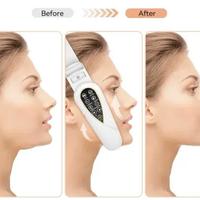 Tecnologia di massaggio facciale V face slimming