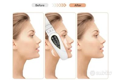 Tecnologia di massaggio facciale V face slimming