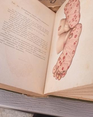 Atlas der Syphilis von Fr.Mracek