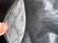 Immagine 6