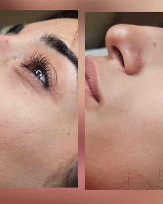 Extension ciglia
