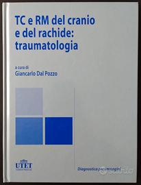 TC e RM del cranio e del rachide: traumatologia