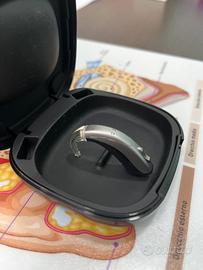 Apparecchio acustico