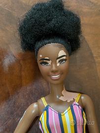 Barbie Fashionista 135 Vitiligo