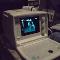 ecografo portatile medison sa600+stampante+3 sonde