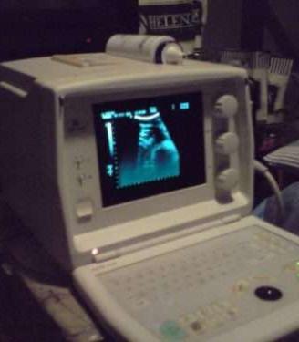 ecografo portatile medison sa600+stampante+3 sonde