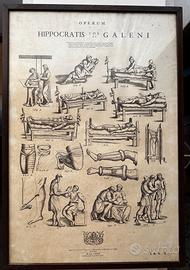 4 Tavole Mediche Antiche- Ippocrate e Galeno-1679