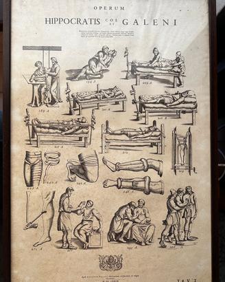 4 Tavole Mediche Antiche- Ippocrate e Galeno-1679