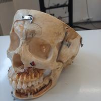 Cranio vero scomponibile di essere umano 