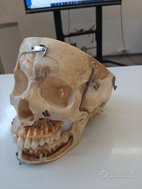 Cranio vero scomponibile di essere umano 