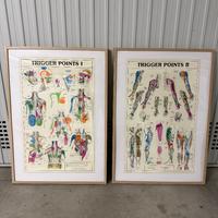 Poster trigger point