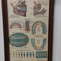 litografia per dentisti
