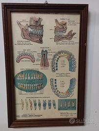 litografia per dentisti