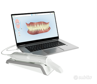 iTero Element Flex SCANNER 3D DENTALE  DENTI ROMA