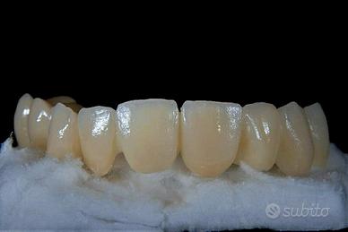 Odontotecnico ceramista esperto