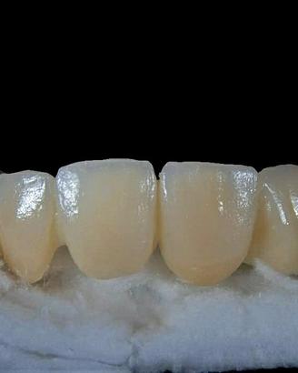 Odontotecnico ceramista esperto