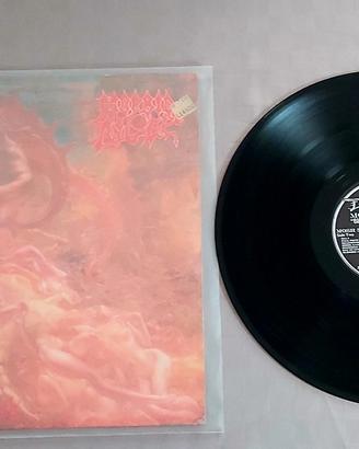 vinile