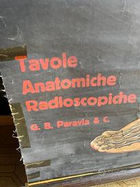 TAVOLA RADIOSCOPICA