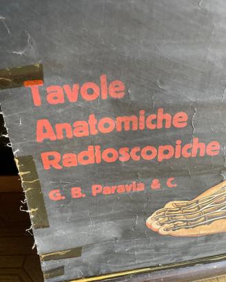 TAVOLA RADIOSCOPICA