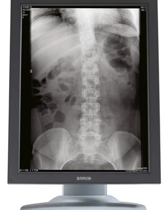 Monitor medicale BARCO