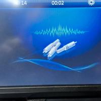 autoradio 