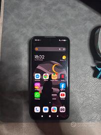 Xiaomi 14 ultra problemi alla telecamera posterior