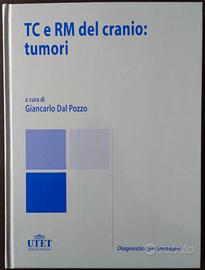 Diagnostica per immagini, TC e RM cranio: tumori