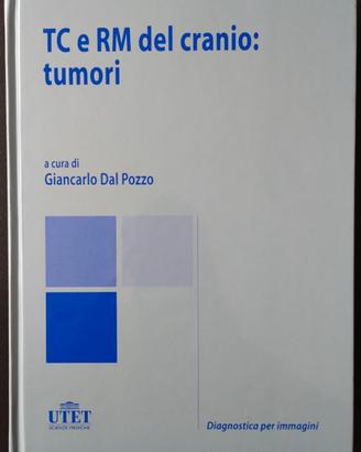 Diagnostica per immagini, TC e RM cranio: tumori