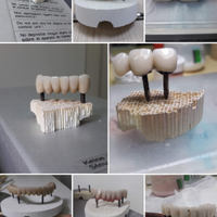 Odontotecnico ceramista